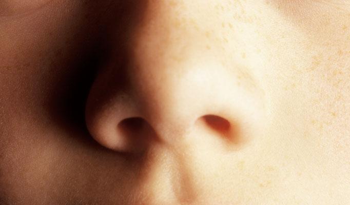 Фото Искривление носовой перегородки: как вдохнуть полной грудью